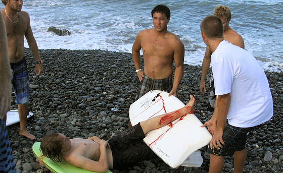 Maui shark attack: when surfers help each other