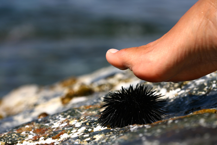 Sea urchin sting: painful and potentially deadly | Photo: Shutterstock
