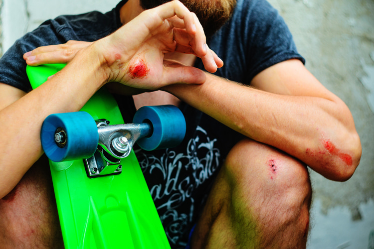 Skateboard injuries: the most common injury among beginner skaters is sprained wrists | Photo: Shutterstock