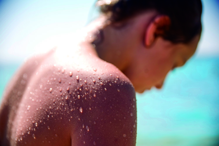 Surfing: exposure to salt, sun, and sand can easily stress a surfer skin | Photo: Creative Commons