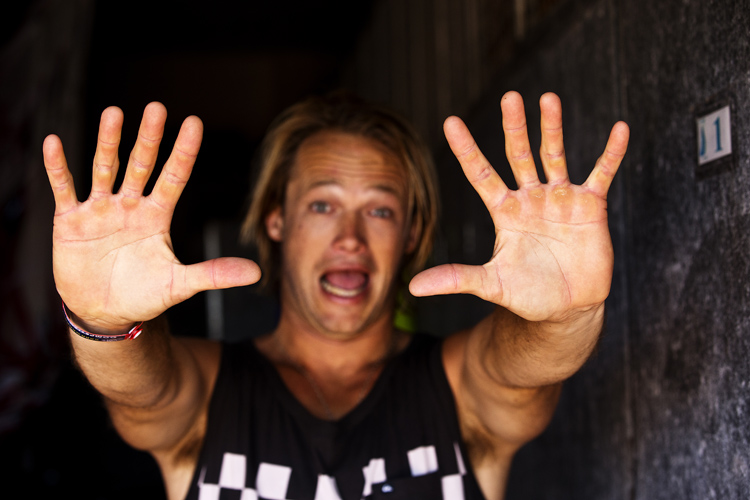 Windsurfer hands: blisters and calluses are part of the job | Photo: Carter/PWA